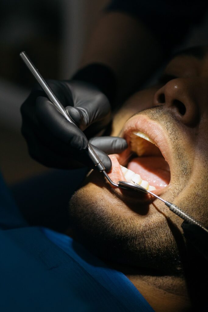 Close-up view of a patient undergoing a dental checkup with a mouth mirror in a clinic.